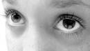 ���� freckles and eyes