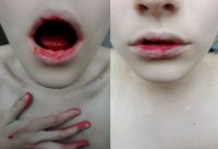 ������
